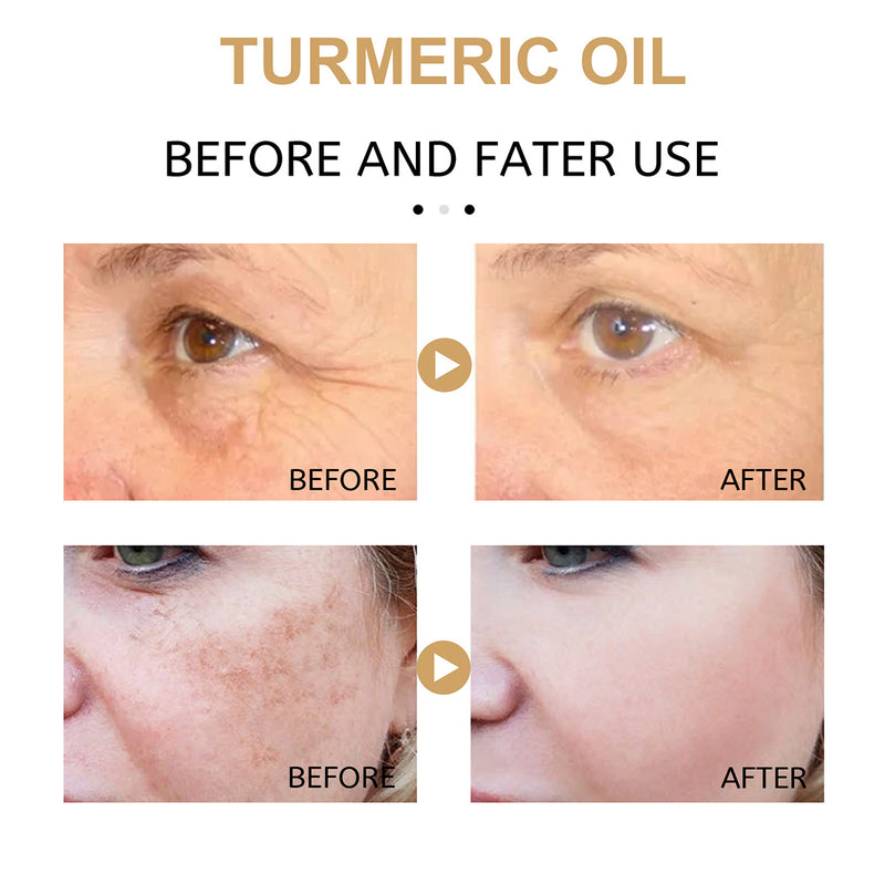 Turmeric Essential Oil, Remove Wrinkles Dark Spot Corrector Face Whitening Cream for Womens